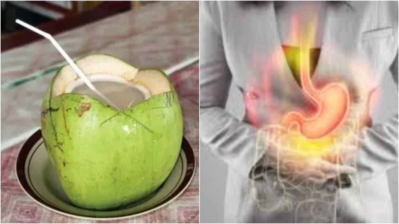 एसिडिटी से राहत दिलाएंगे ये घरेलू नुस्खे.