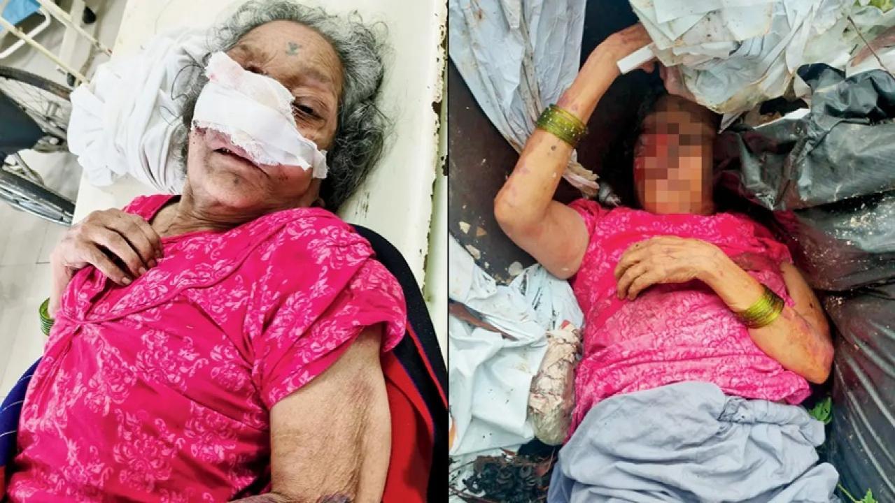 Iमहिला को पोते ने आरे में कूड़े के ढेर में फेका, पुलिस ने अस्पताल में कराया भर्ती