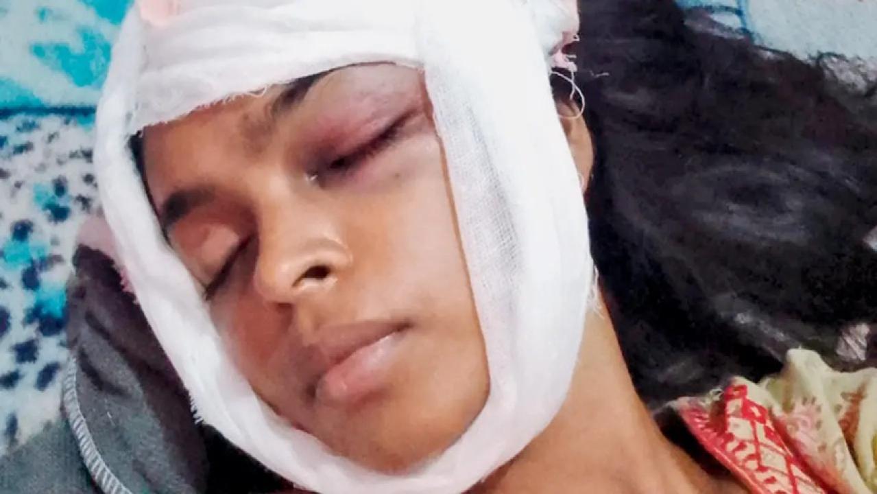 Iकुत्ते के शौच पर विवाद: ऐरोली में महिला पर पड़ोसी ने किया घर में घुसकर हमला