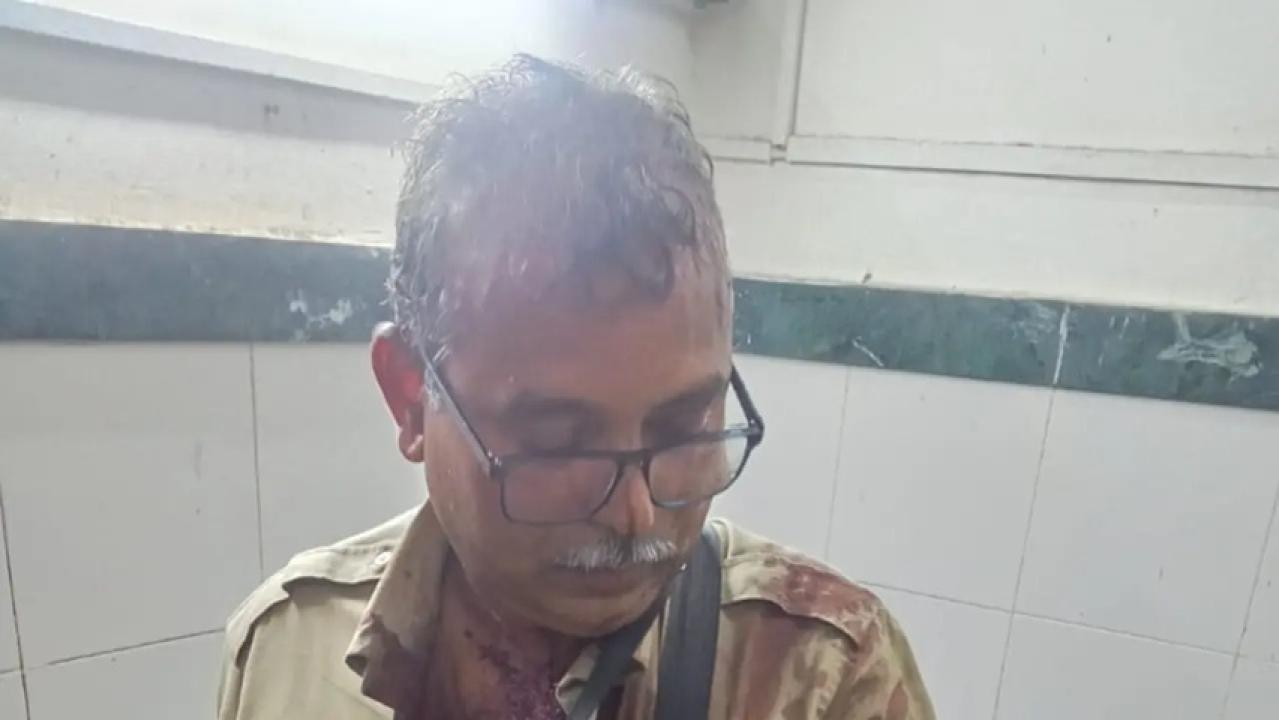 Iचेंबूर में बेस्ट बस कंडक्टर पर यात्री का हमला, CCTV खराब होने का आरोप