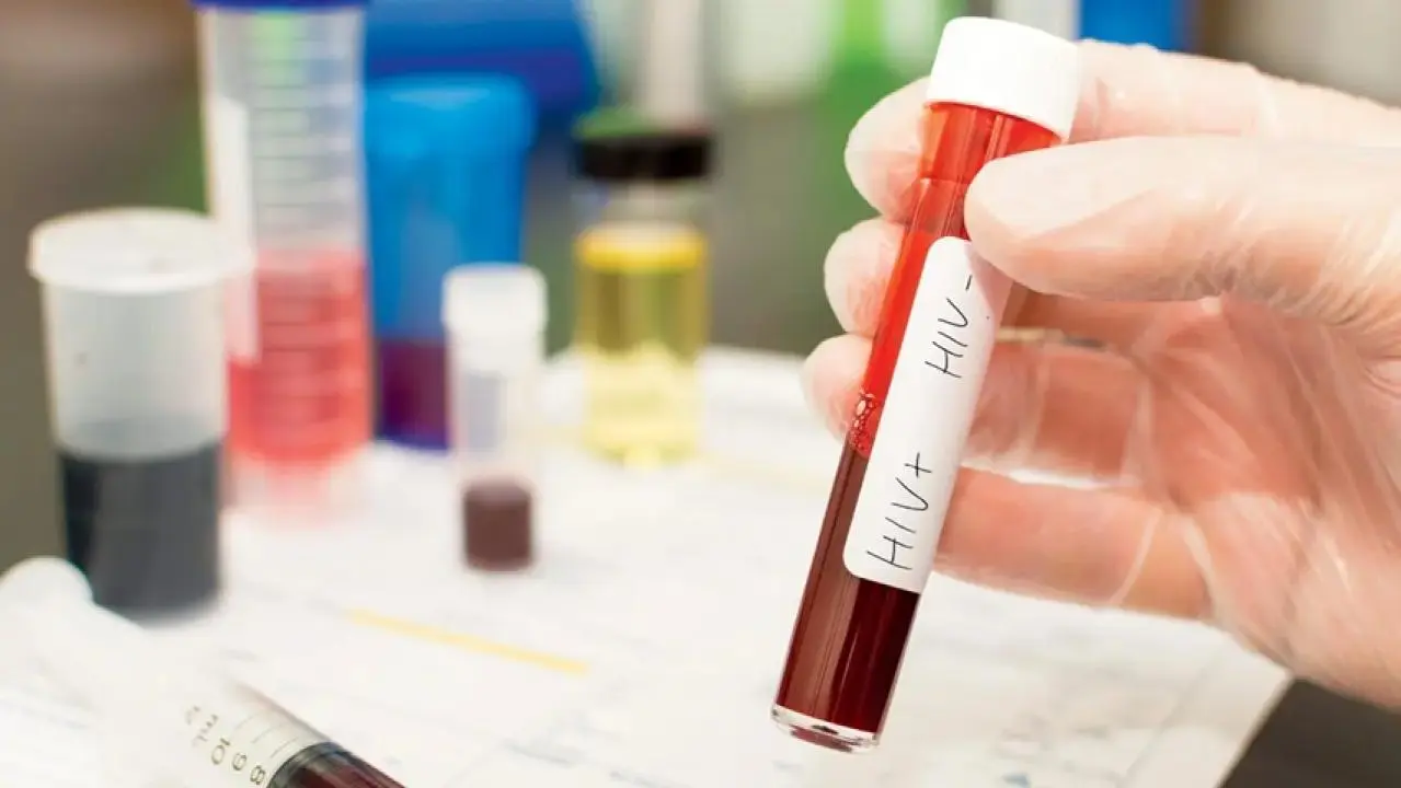Iमुंबई में तस्करी से बचाई गई 14 बांग्लादेशी महिलाओं में से 7 पाई गईं HIV पॉजिटिव