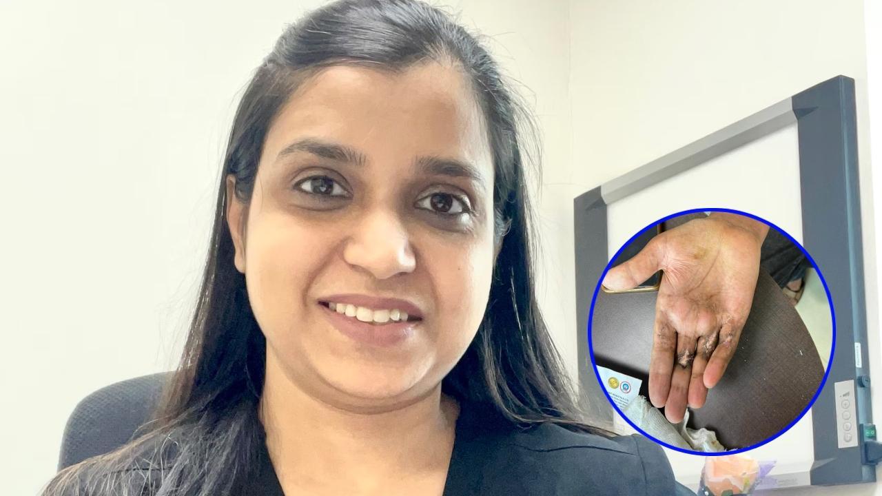 सर्जरी में हड्डियों को स्थिर करने, ऊतकों को संरक्षित करने और त्वचा का प्रारंभिक ग्राफ्ट करने की प्रक्रिया शामिल थी. 