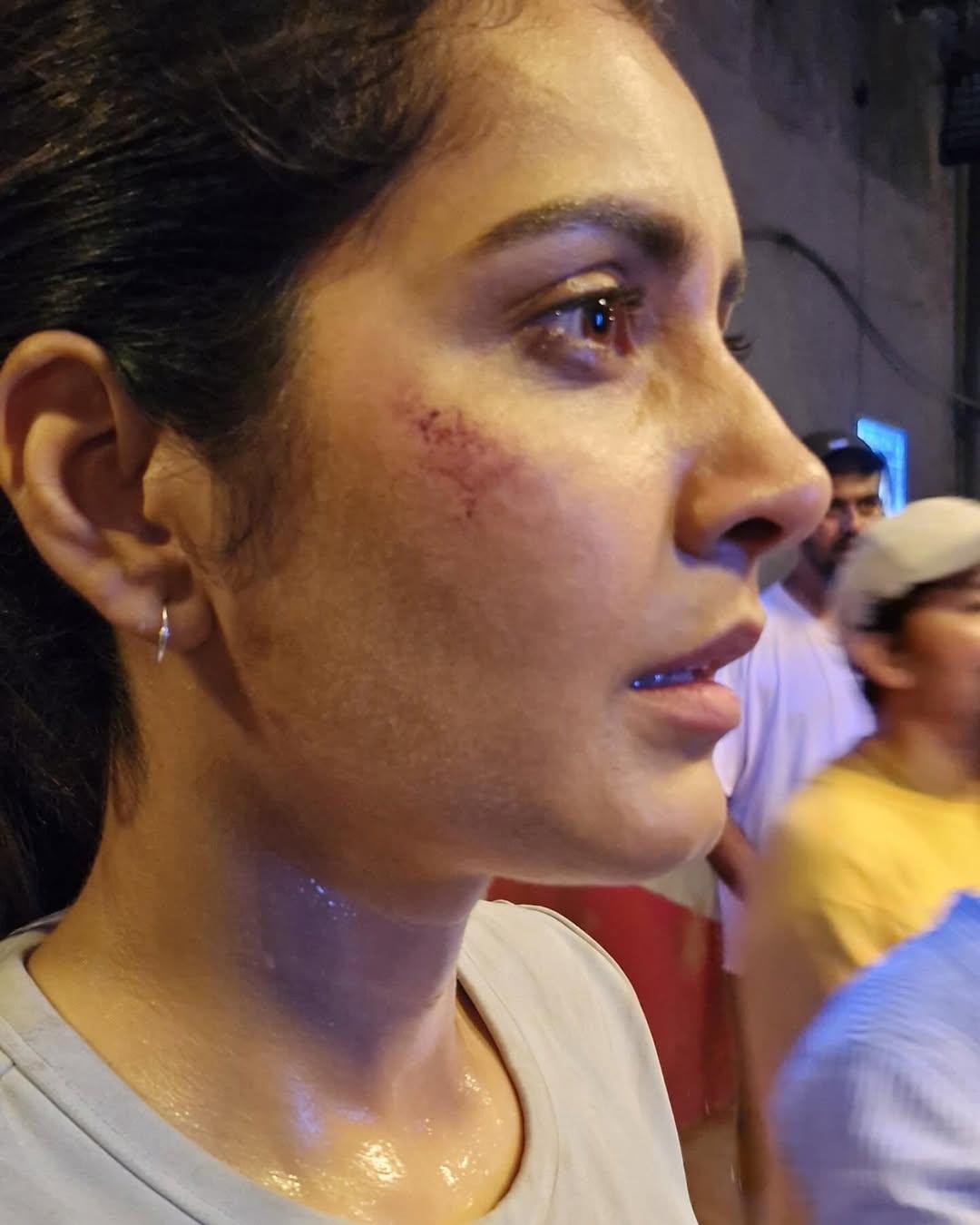 मेकअप, लाइटिंग और एक्सप्रेशन ने इस तस्वीर को और भी प्रभावशाली बना दिया है. पोस्ट के कैप्शन में राशि ने लिखा: “कुछ किरदार मांगते हैं... तुम्हारा शरीर, तुम्हारी साँसें, तुम्हारे ज़ख्म. जब तुम तूफ़ान बनते हो, तो बिजली की गड़गड़ाहट से नहीं डरते. जल्द आ रही है…”